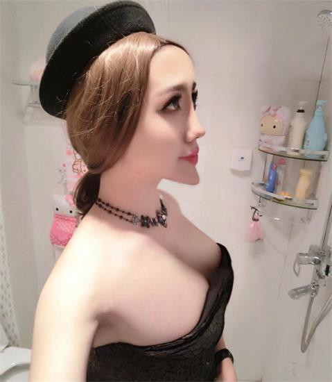 又見整容奇葩 蛇精男成蛇精女 又見整容奇葩 蛇精男成蛇精女