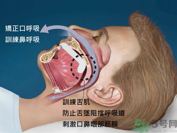 干燥癥是怎么得的?不能離開水? 干燥癥是怎么得的?不能離開水?