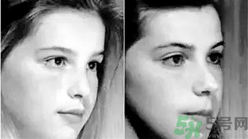 張嘴睡覺是什么原因 張嘴睡覺越長越丑嗎 張嘴睡覺是什么原因 張嘴睡覺越長越丑嗎