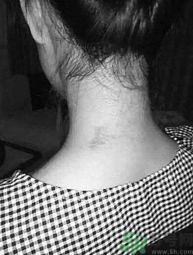 老師水潑女生遭腳踢后流產(chǎn) 老師打我我該怎么辦 老師水潑女生遭腳踢后流產(chǎn) 老師打我我該怎么辦