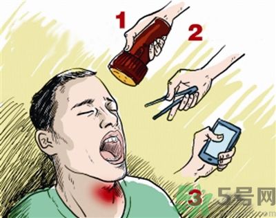 魚刺卡喉喝醋可以治療嗎？魚刺卡喉喝醋好不好？