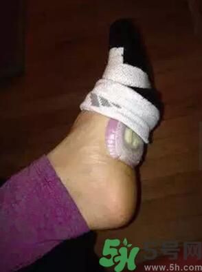 發(fā)燒可以吃洋蔥嗎？發(fā)燒能吃洋蔥嗎？