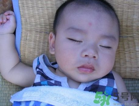 寶寶被蚊子咬了怎么快速止癢消腫? 寶寶被蚊子咬了怎么快速止癢消腫?