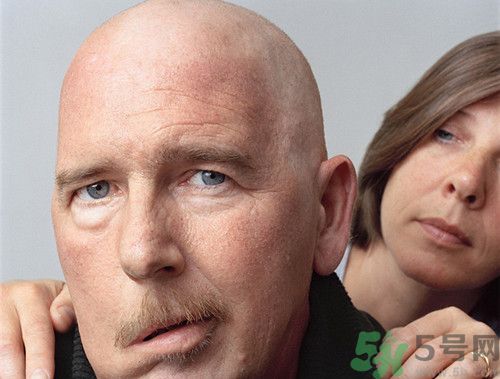 吹空調(diào)會不會面癱?吹空調(diào)面癱怎么辦 吹空調(diào)會不會面癱?吹空調(diào)面癱怎么辦