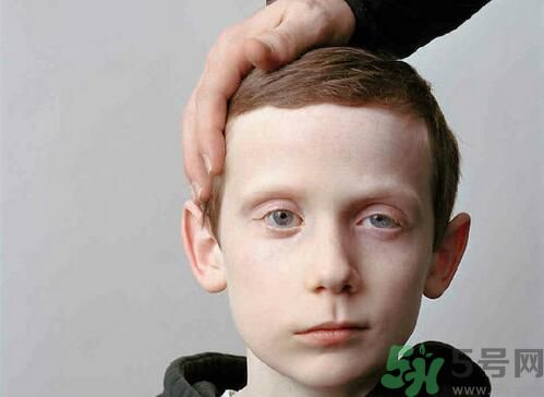 吹空調(diào)會(huì)不會(huì)面癱?吹空調(diào)面癱怎么辦 吹空調(diào)會(huì)不會(huì)面癱?吹空調(diào)面癱怎么辦