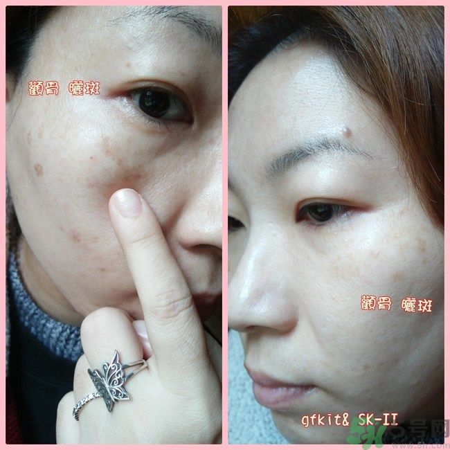 sk2祛斑精華怎么樣？skii祛斑精華使用方法
