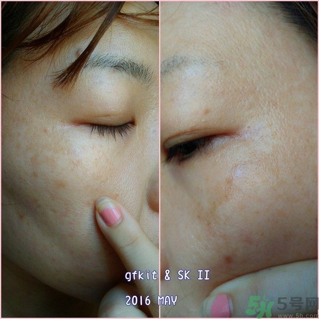 sk2祛斑精華怎么樣？skii祛斑精華使用方法