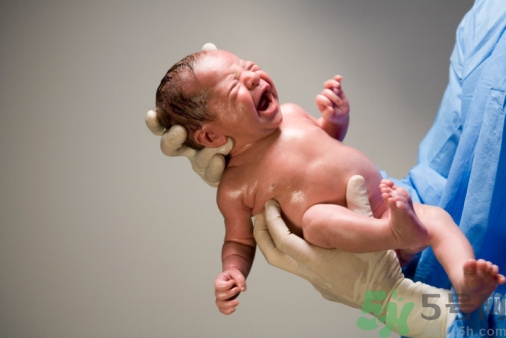 側(cè)切傷口多久能好?產(chǎn)后側(cè)切傷口如何護(hù)理 側(cè)切傷口多久能好?產(chǎn)后側(cè)切傷口如何護(hù)理