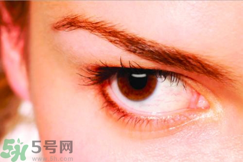 睡醒后眼睛有紅血絲是怎么回事? 睡醒后眼睛有紅血絲是怎么回事?