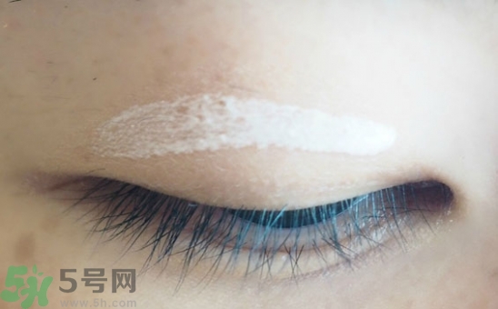 單眼皮怎么變雙眼皮了？單眼皮上面有一條線