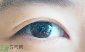 單眼皮怎么變雙眼皮了？單眼皮上面有一條線