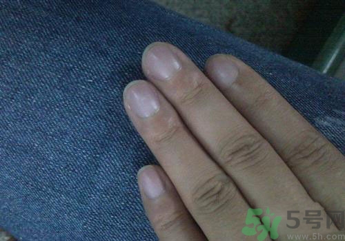 指甲發(fā)紫是什么原因？指甲發(fā)紫是怎么回事？
