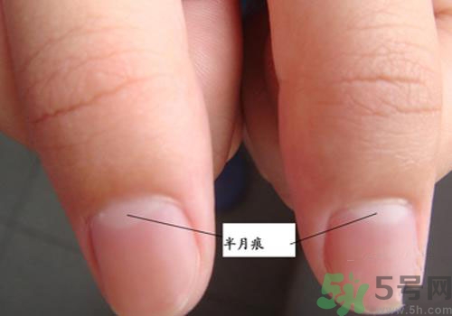 指甲沒有月牙是什么原因？指甲沒有月牙怎么調(diào)理？