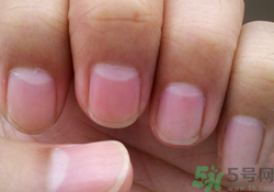 指甲沒(méi)有月牙是什么原因？指甲沒(méi)有月牙怎么調(diào)理？