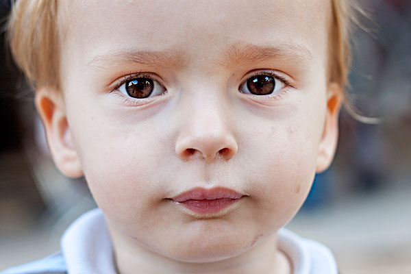 眼結(jié)石是怎么形成的？眼結(jié)石可以自己消失嗎？