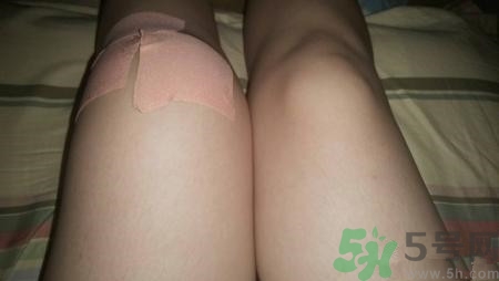 半月板是什么意思?半月板損傷能自愈嗎 半月板是什么意思?半月板損傷能自愈嗎