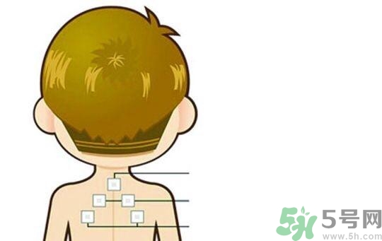 貼三伏貼可以吹空調(diào)嗎？貼完三伏貼多久后可以吹空調(diào)？