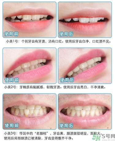 musee速攻美白牙齒清潔橡皮擦是什么?musee美白牙齒好用嗎? musee速攻美白牙齒清潔橡皮擦是什么?musee美白牙齒好用嗎?