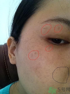 pola美白丸怎么樣?pola美白丸有用嗎? pola美白丸怎么樣?pola美白丸有用嗎?