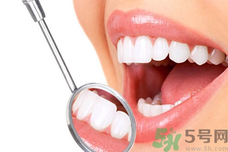 哪些人不能洗牙？洗牙需要注意什么？