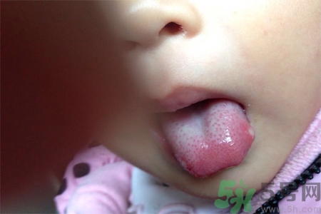 舌頭長泡怎么辦？舌頭長泡的原因？