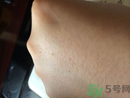 手上長小疙瘩很癢怎么回事?手上長小疙瘩怎么辦 手上長小疙瘩很癢怎么回事?手上長小疙瘩怎么辦