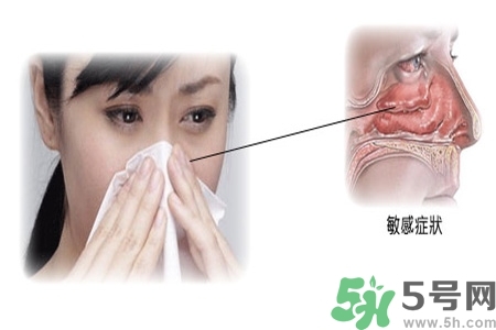 過(guò)敏性鼻炎的高發(fā)人群有哪些？如何預(yù)防過(guò)敏性鼻炎？