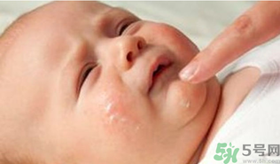 寶寶長奶蘚怎么回事？寶寶長奶蘚怎么辦？