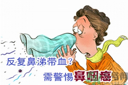 鼻咽癌是什么？鼻咽癌的癥狀有哪些？