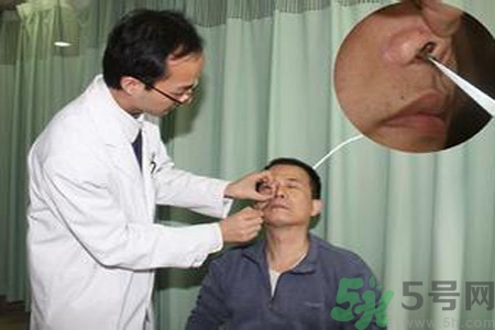 鼻咽癌的治療方法是什么？鼻咽癌可以用什么藥物治療？