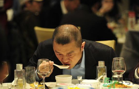 男人禿頂會(huì)遺傳嗎？男人禿頂是腎虛嗎？