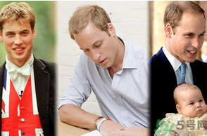 男人禿頂會(huì)遺傳嗎？男人禿頂是腎虛嗎？