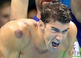 拔火罐后可以運動嗎?拔罐后多久能運動? 拔火罐后可以運動嗎?拔罐后多久能運動?