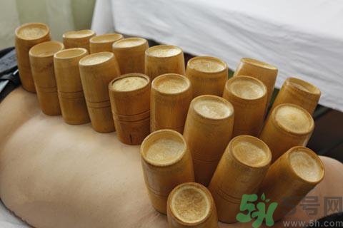 拔火罐后可以運動嗎?拔罐后多久能運動? 拔火罐后可以運動嗎?拔罐后多久能運動?