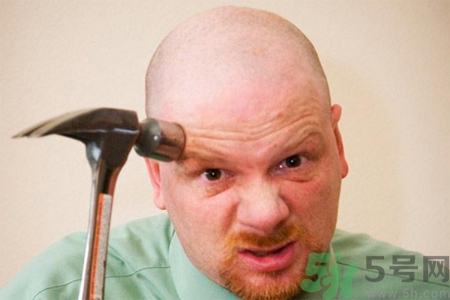 脫發(fā)的高發(fā)人群有哪些？如何預(yù)防脫發(fā)？