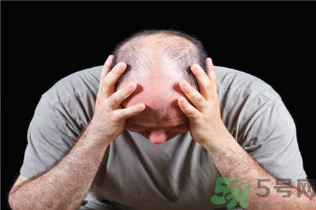 脫發(fā)的高發(fā)人群有哪些？如何預(yù)防脫發(fā)？