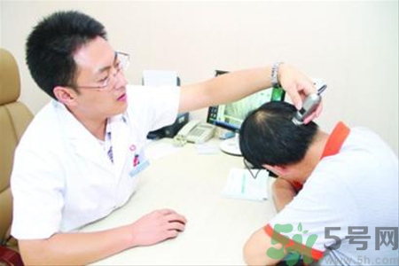 脫發(fā)會(huì)遺傳嗎？脫發(fā)遺傳可以治療嗎？