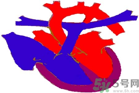 先天性心臟病發(fā)病原因是什么？