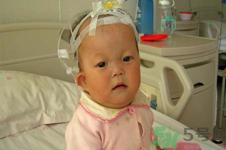 先天性心臟病可以用藥物治療嗎？