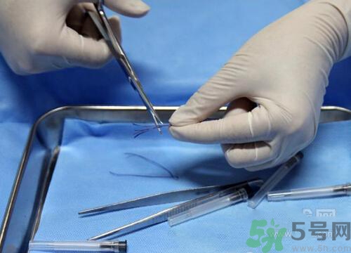 埋線減肥多少錢一次？埋線減肥的副作用