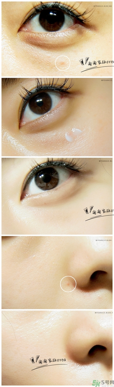 韓國23years old祛痘霜怎么樣 23 years old祛痘膏好用嗎 韓國23years old祛痘霜怎么樣 23 years old祛痘膏好用嗎