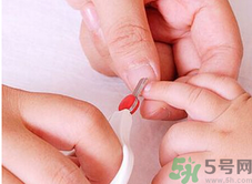 寶寶長蘚是怎么回事？寶寶長蘚怎么辦？