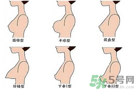 ?女性乳房下垂的原因是什么？女性乳房下垂的分類(lèi)有哪些？