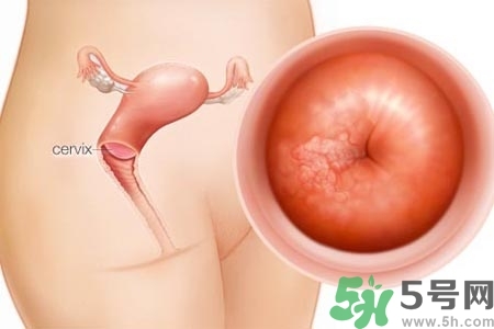 陰道出血癥狀有哪些？陰道出血需注意什么問題？