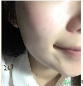 麗得姿面膜適合孕婦可以用嗎？麗得姿面膜哪些孕婦可以用？