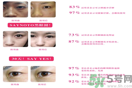 自然之名雪玫瑰雪蒸汽眼霜適合什么年齡？自然之名雪玫瑰雪蒸汽眼霜價格多少？