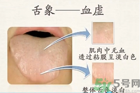 血虛怎么調(diào)理？女人血虛怎么調(diào)理？