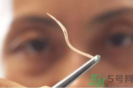 如何避免魚刺卡喉嚨？魚刺卡喉嚨如何處理？