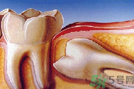 多少歲開始長智齒？智慧牙長到多少歲？