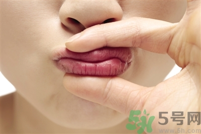 孕婦嘴唇干裂脫皮怎么回事？孕婦嘴唇干裂脫皮是缺什么